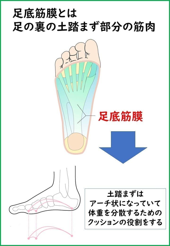 足底筋膜