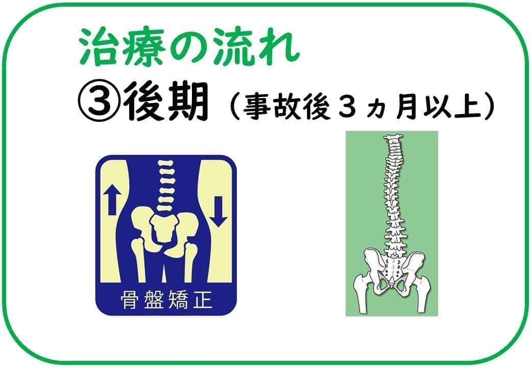 治療の流れ③