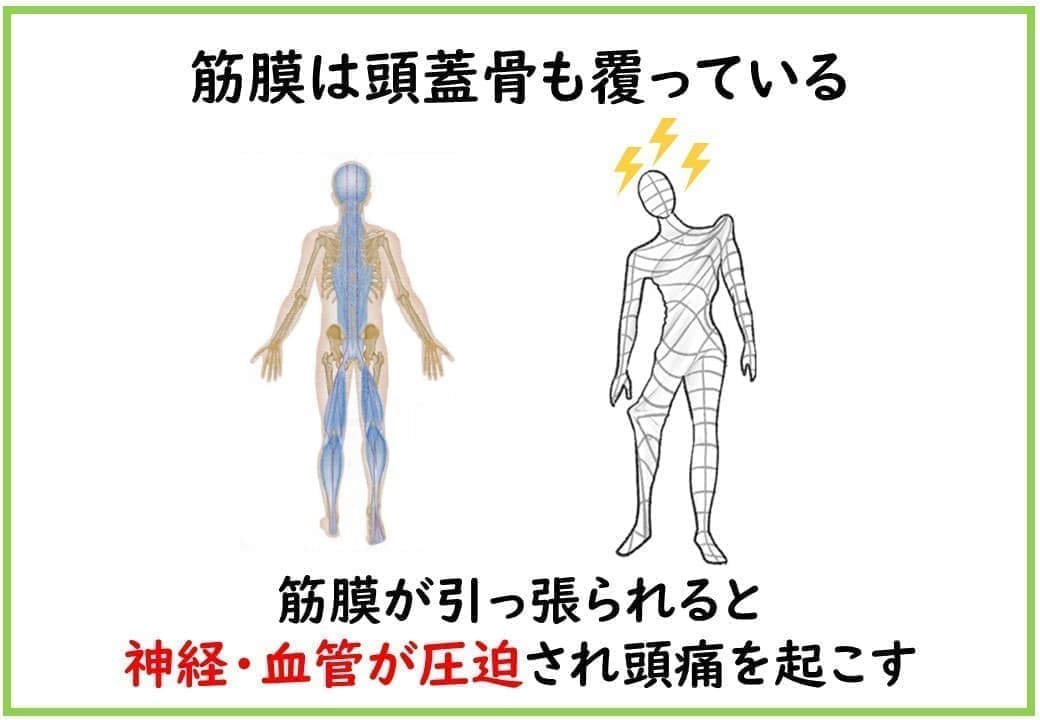 筋膜は頭蓋骨も覆っている