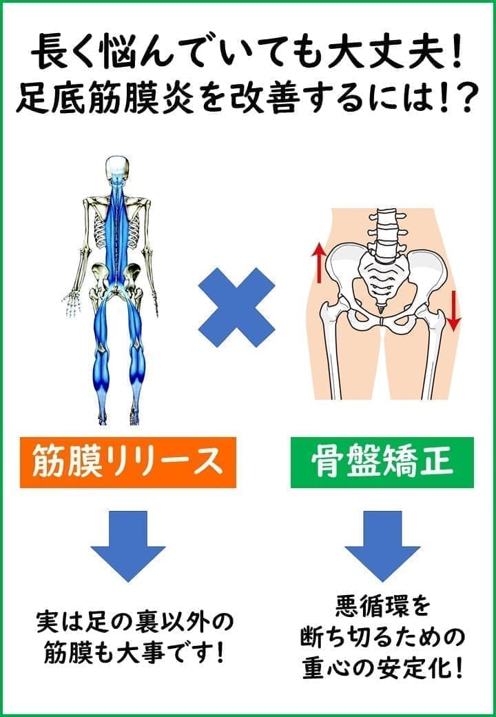 足底筋膜炎を改善するには