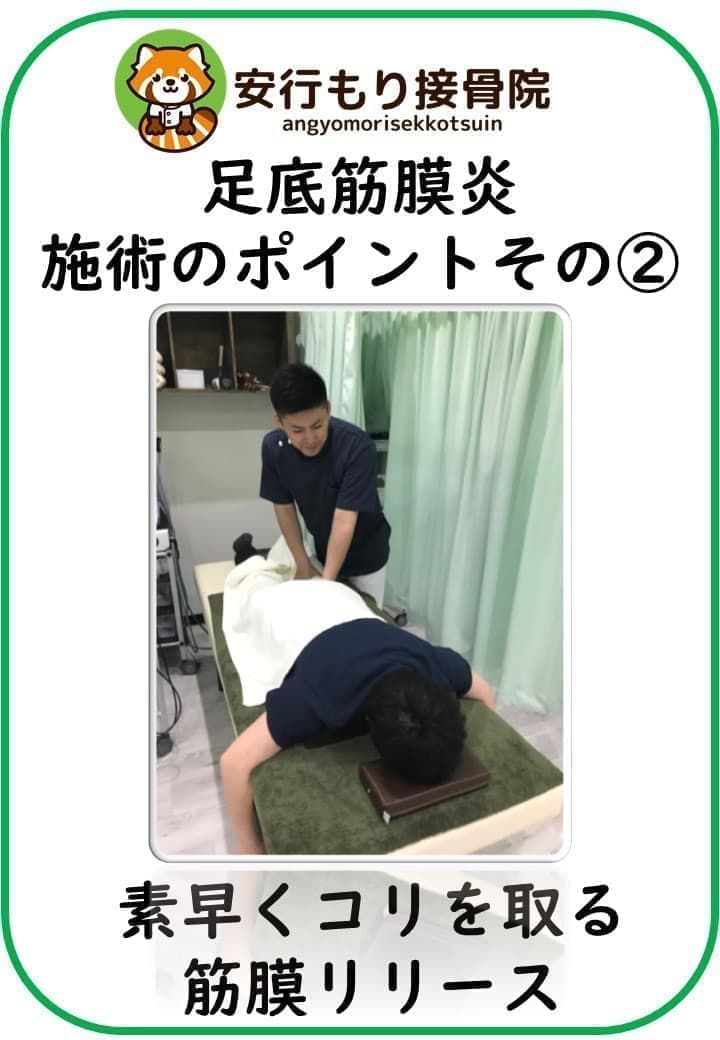 足底筋膜炎の施術ポイント②