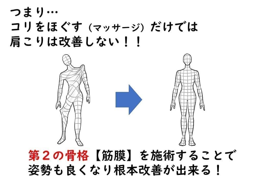 マッサージで肩こりは改善しない