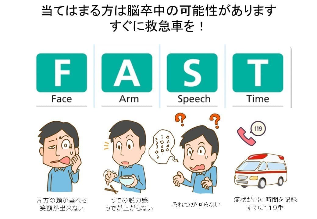 FAST