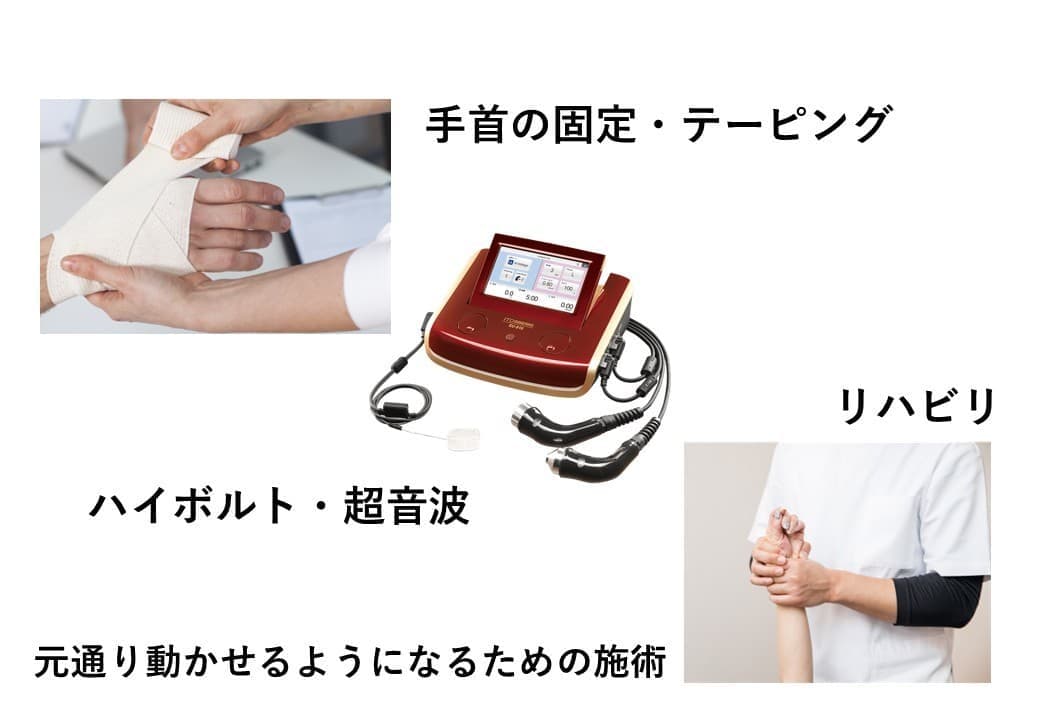 ねんざの施術